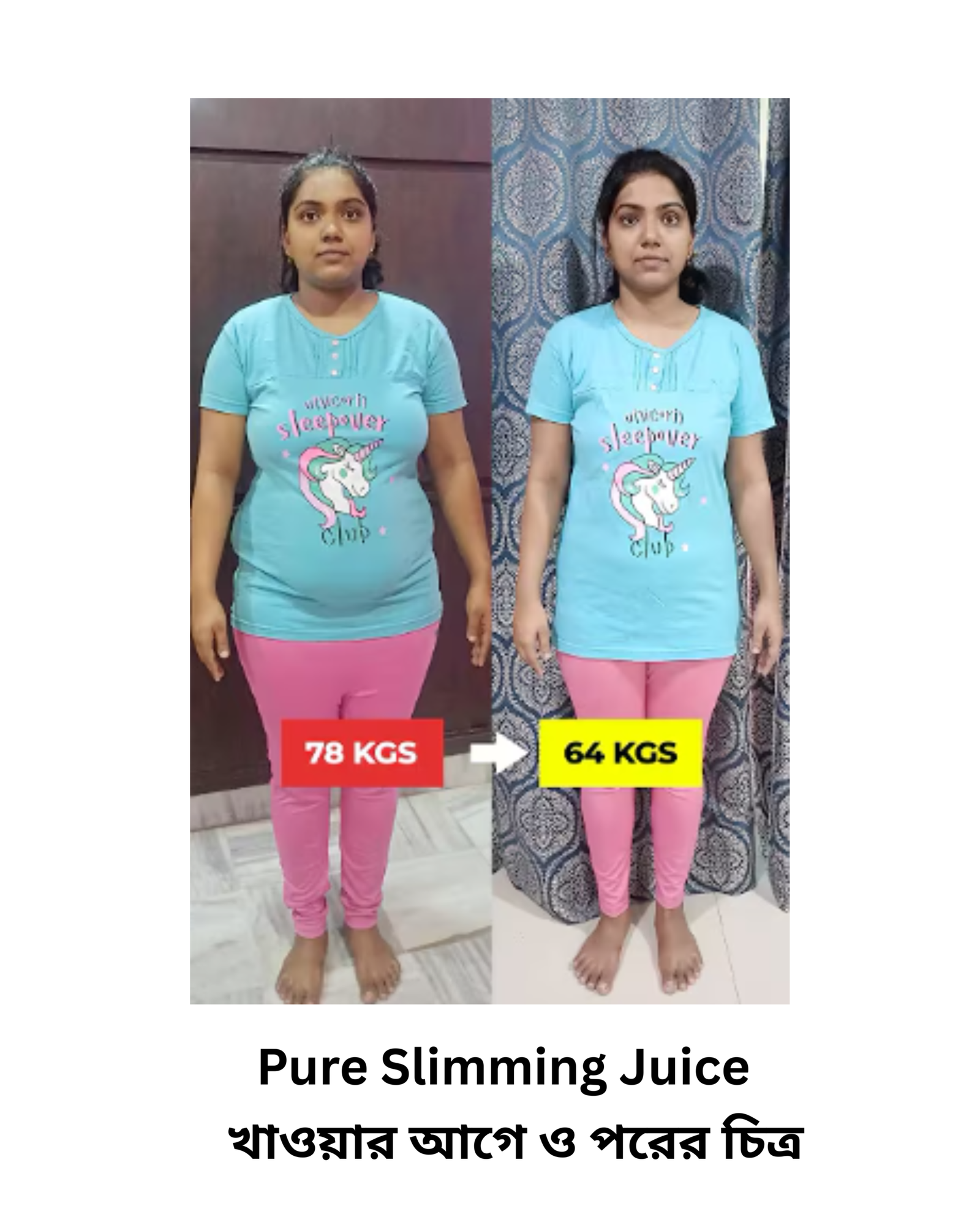 pure slimmingjuice খাওয়ার আগে ও পরের চিত্র